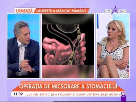 Care sunt riscurile operaţiei de micşorare a stomacului