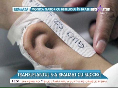 Un medic specializat în chirurgie plastică a crescut o ureche pe mâna pacientului