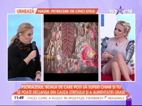 Suferi de psoriazis? Specialiştii &icirc;ţi spun totul despre această boală şi cum poate fi ţinută ea &icirc;n fr&acirc;u