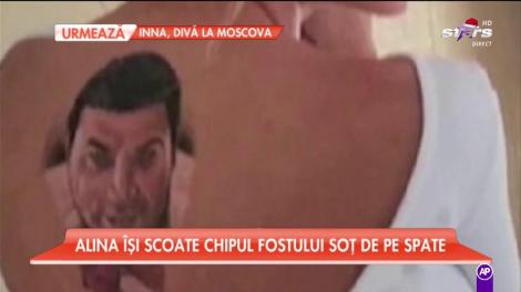 Alina Vidican a decis să-şi şteargă şi tatuajul de pe mână, cu numele lui Borcea