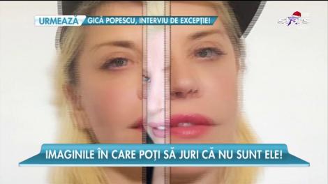 Divele României, de nerecunoscut, din cauza operaţiilor estetice!