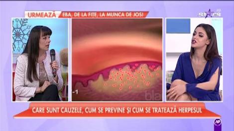 Care sunt cauzele, cum se previne și cum se tratează herpesul