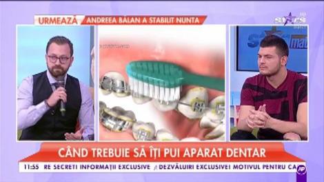 Vrei să ai zâmbet de reclamă? Aparatul dentar este soluția!