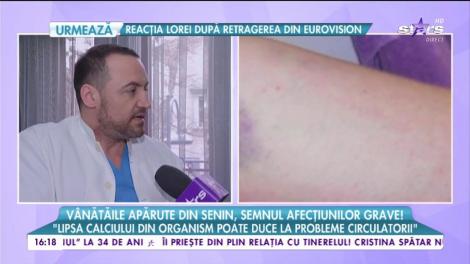 Vânătăile apărute din senin, semnul unor afecțiuni grave