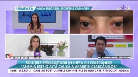 Cum se tratează corect cearcănele