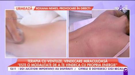 Ce boli se pot trata cu ajutorul ventuzelor