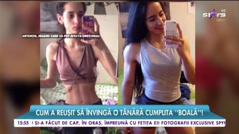 Anorexia putea să o ucidă, dar a devenit o bombă sexy