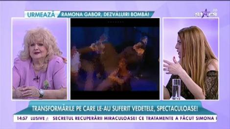 Transformările pe care le-au suferit vedetele, spectaculoase!