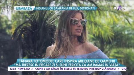 Și-a pierdut piciorul într-un accident, dar nu s-a dat bătută! Tânăra fotomodel care inspiră milioane de oameni: "Sunt fericită că încă sunt în viaţă"