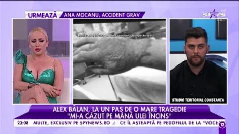 Alex Bălan, fost concurent de la „Chefi la cuţite”, accident cumplit în bucătărie! „Medicii mi-au spus să renunţ la meseria de bucătar"