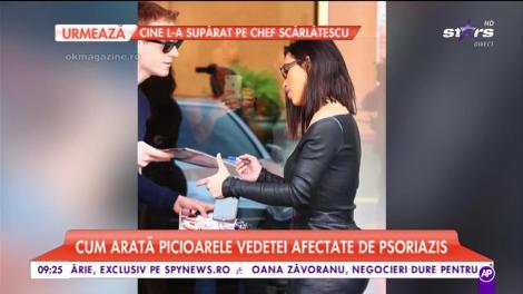 Kim Kardashian își dă cu stângul în dreptul. A încercat să-și ascundă o boală de care suferă, de mulți ani, și s-a făcut de râs