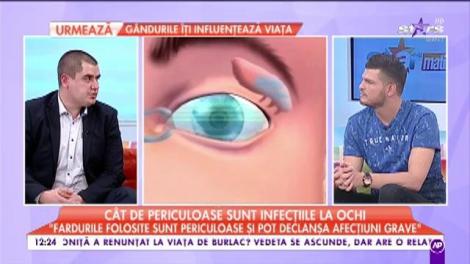 Cât de periculoase sunt genele false pentru ochi: ”Conjunctivita este cea mai întâlnită afecțiune”