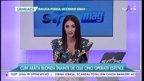 Imagini bombă cu Valentina Pelinel! Cum arăta blonda înainte de cele 5 intervenții chirurgicale!