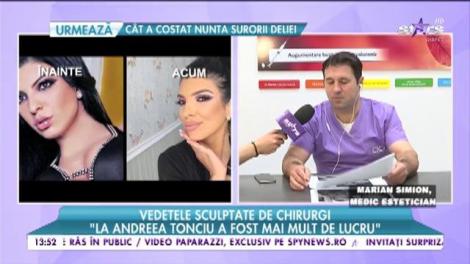 Vedetele sculptate de chirurgi