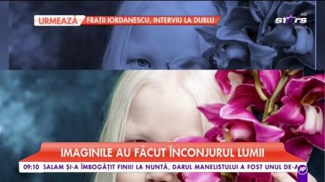 Nariyana, o fetiță de opt ani, suferă de albinism. Boala a transformat-o într-una dintre cele mai dorite fotomodele