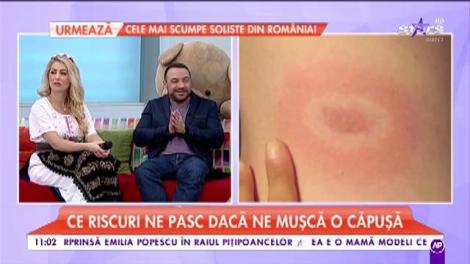 Cum ne tratăm după ce suntem mușcați de căpușe