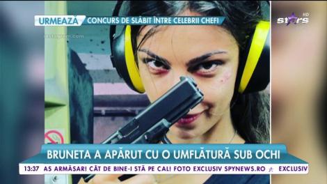 Mădălina Ghenea, semn suspect pe față! Bruneta a apărut cu o umflătură sub ochi