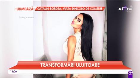 Divele, înainte şi după operaţiile estetice! Din răţuşte, medicii le-au transformat în adevărate lebede!