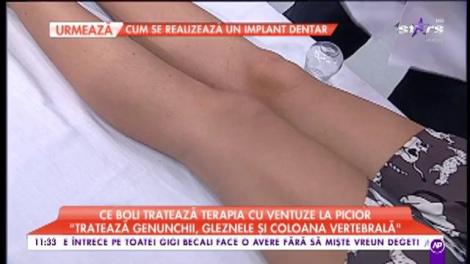 Terapia cu ventuze la picior, senzație în rândul divelor de la Hollywood