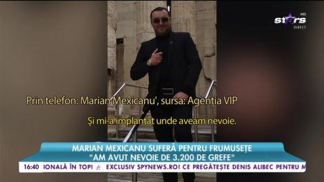 Marian Mexicanu sufera pentru frumusete: ”Mi-am implantat păr unde trebuia”