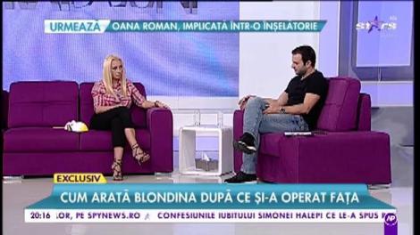 Simona Trașcă, imagini șoc! Prima dată cu fața descoperită, după operația din cauza căreia a vrut să se sinucidă: „Mai am tăieturi mici care se vor cicatriza ușor, ușor”