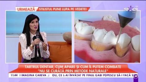 Știai că tartrul dentar trebuie îndepărtat periodic?