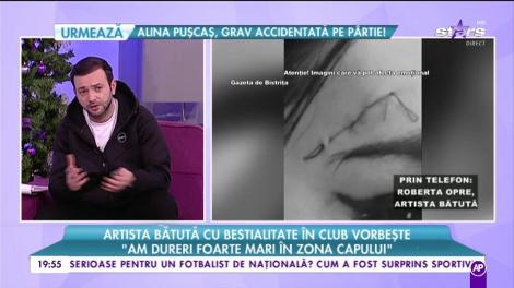 Artista bătută cu bestialitate în club vorbește: ”Și soțul meu are sechele