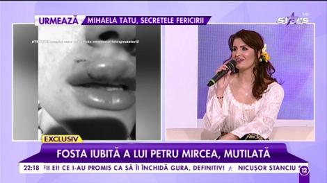 Geanina Manea, fosta iubită a lui Petru Mircea, mutilată de muşcătura unui câine!