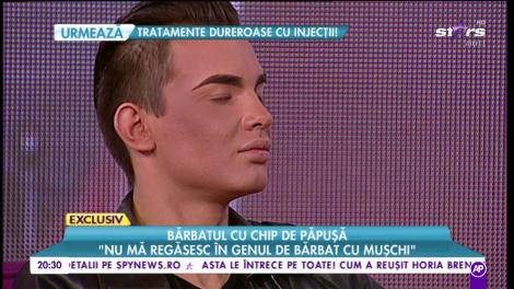 Bărbatul cu chip de păpușă. Și-a modificat buzele, pomeții și cearcănele pentru a semăna cu idolul său