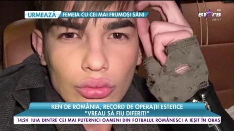 Ken de România, record de operații estetice: „Vreau să fiu diferit!”
