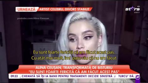 Una dintre cele mai frumoase românce recunoaște că și-a tăiat nasul: „Nu mă simțeam bine cu nasul meu”