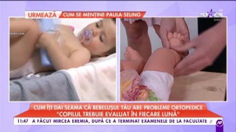 Știai că și bebelușii pot avea probleme ortopedice? „Copilul trebuie evaluat în fiecare lună”