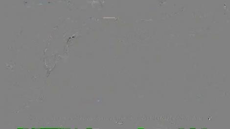 Ce afecțiuni ascunde durerea de spate. Durerile sunt provocate de condus sau pozițiile greșite