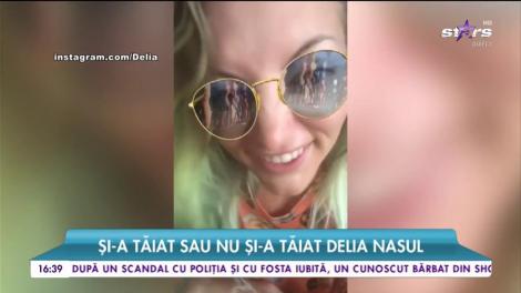 Delia, adevărul despre rinoplastie! Cum a răspuns artista după ce a fost acuzată că și-a operat nasul:”Nu pot să vă mint”