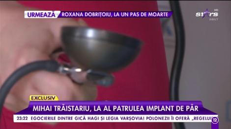 Mihai Trăistariu, din nou pe masa de operație. Artistul, la al patrulea implant de păr