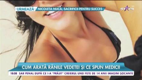 Imagini incendiare cu vedetele în ținute minuscule