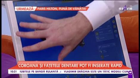 Noua metodă de restaurare dentară folosită la nivel mondial