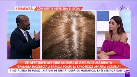 Ce afecțiuni ale organismului ascunde mătreața