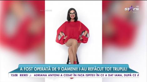 O, Doamne, ce chin! Prin ce a trecut Ozana Barabancea ca să scape de surplusul de piele: "Când mă dezbrăcam..."