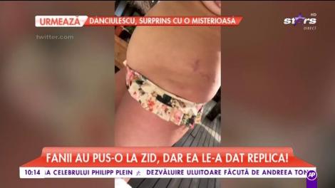 Gest de curaj! Soția lui John Legend și-a arătat vergeturile pe Instagram