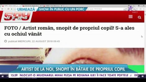 Tudor Ionescu, de la Fly Project, s-a ales cu un ochi vânăt de la fetiţa lui