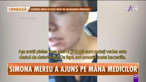 Simona Mereu a ajuns pe mâna medicilor. Dansatoarea preferată a artiștilor are probleme grave cu tenul