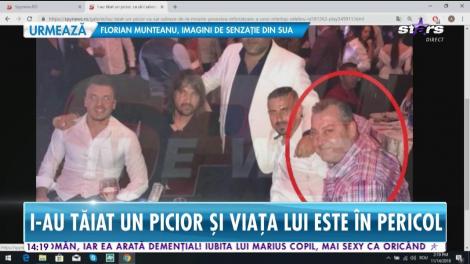 Poveste înfiorătoare a unui controversat om de afaceri! Medicii i-au amputat un picior