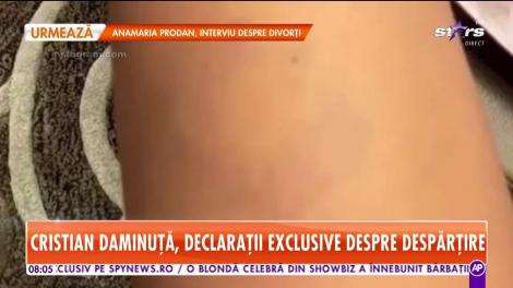 Cristian Daminuţă, primele declaraţii despre despărţire