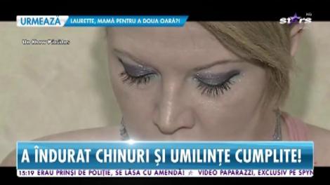 Oana Lis, despre trauma care a mutilat-o pe viață