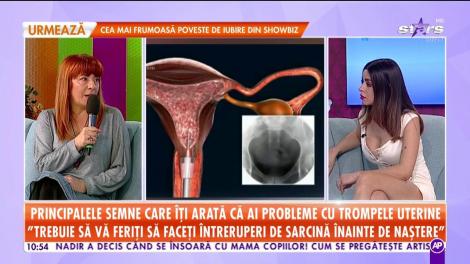Tot ceea ce trebuie să știi despre legarea trompelor uterine