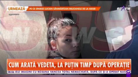 Primele imagini cu Roxana Vancea, după ce și-a operat nasul
