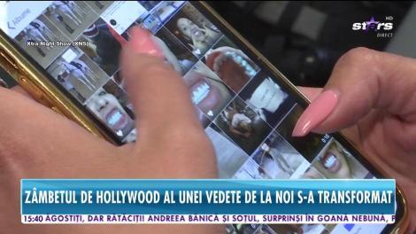 Raluca Podea își lipește dinții căzuți cu adeziv