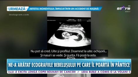 Ioana Grama a arătat ecografiile bebeluşului pe care îl poartă în burtică