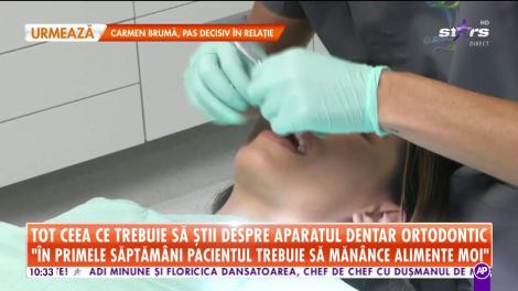 Star Matinal. Vrei să îţi pui aparat dentar pentru a avea dinţi perfecţi? Iată care sunt avantajele şi dezavantajele acestui procedeu medical